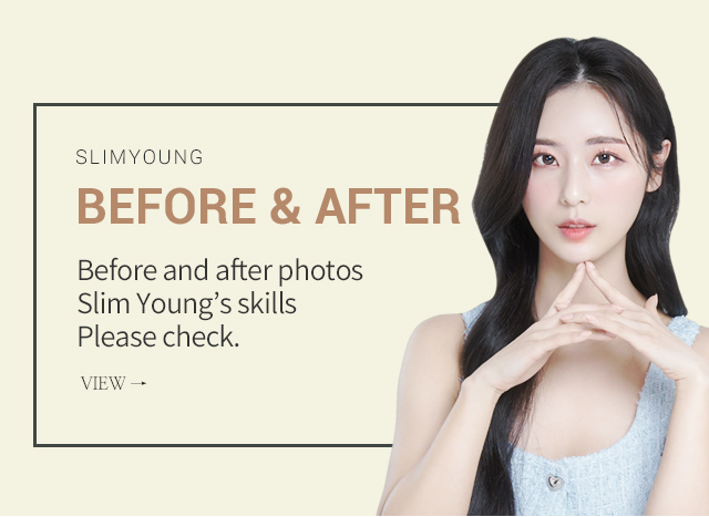 before&after