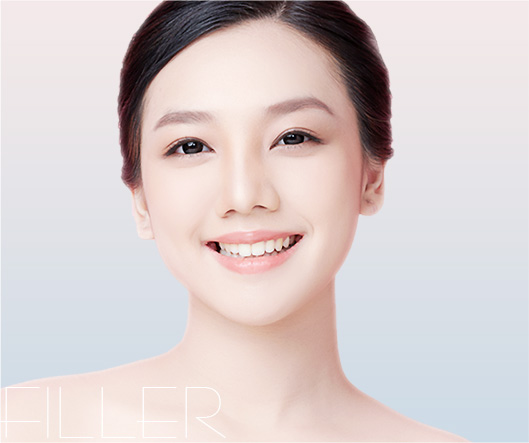 nasolabial fold filler