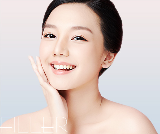 cheek filler