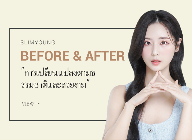 before&after